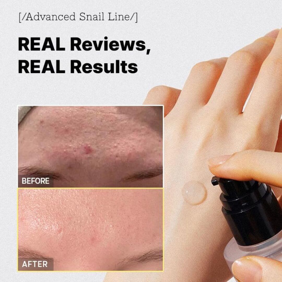 Advanced Snail 96 Mucin Power Essence | COSRX
