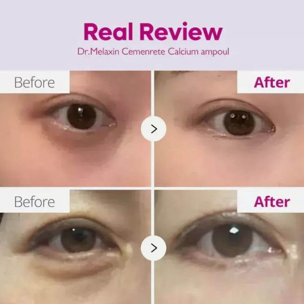 Κρέμα ματιών για άμεσο lifting - Eyephalt Eyebag Cream 10 gr | Dr. melaxin