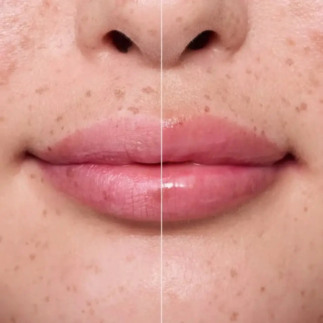 Juicy Serum Hydrating Bi-Phase Lip Treatment 01 Με Υαλουρονικό | Essence